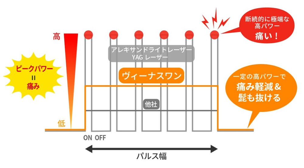 ヴィーナス・ワンの照射